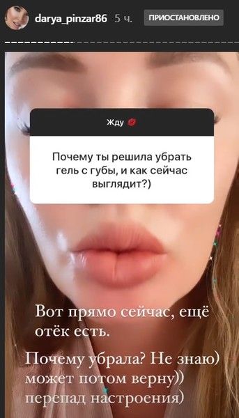 Дарья Пынзарь "откачала" гель с губ